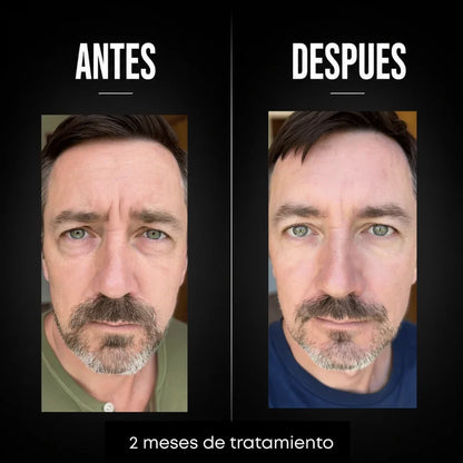 Omen - Crema Hombres Anti-age