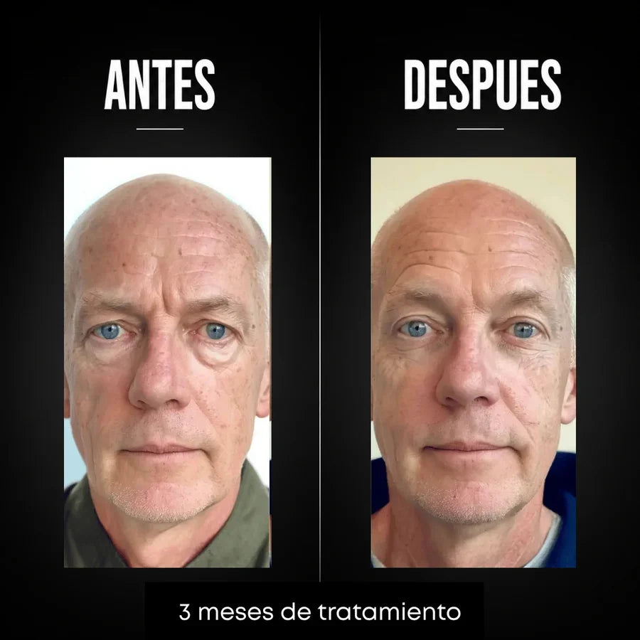 Omen - Crema Hombres Anti-age