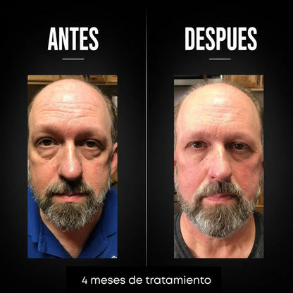 Omen - Crema Hombres Anti-age