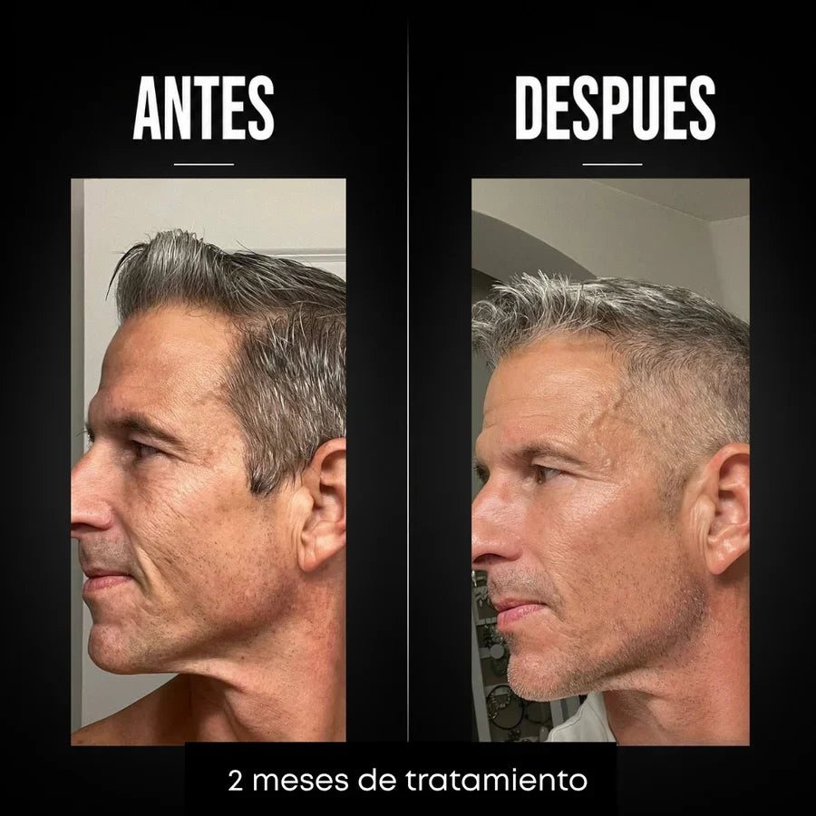 Omen - Crema Hombres Anti-age