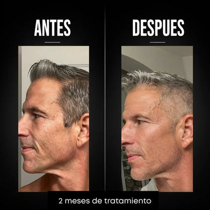Omen - Crema Hombres Anti-age