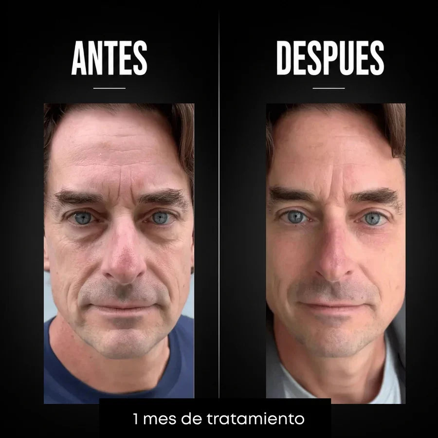 Omen - Crema Hombres Anti-age