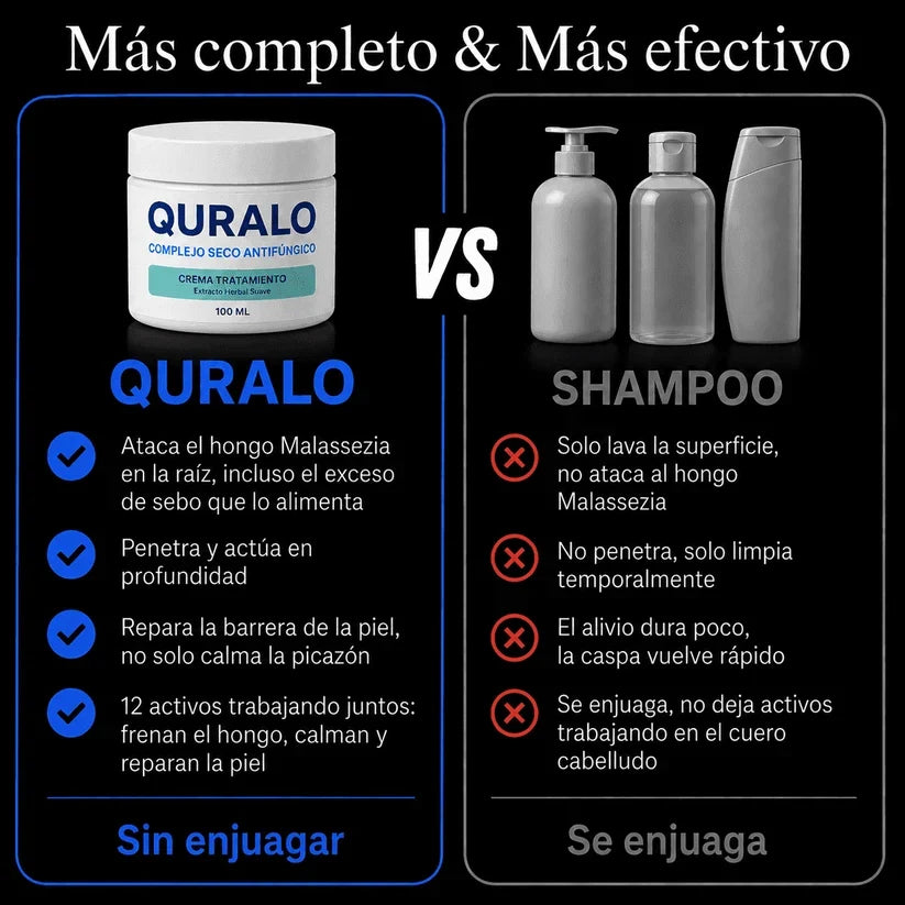 QURALO| Crema contra la caspa y dermatitis seborreica