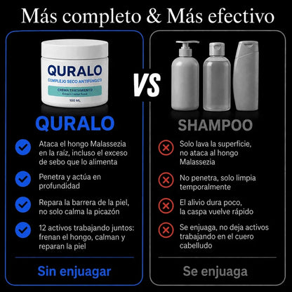 QURALO| Crema contra la caspa y dermatitis seborreica